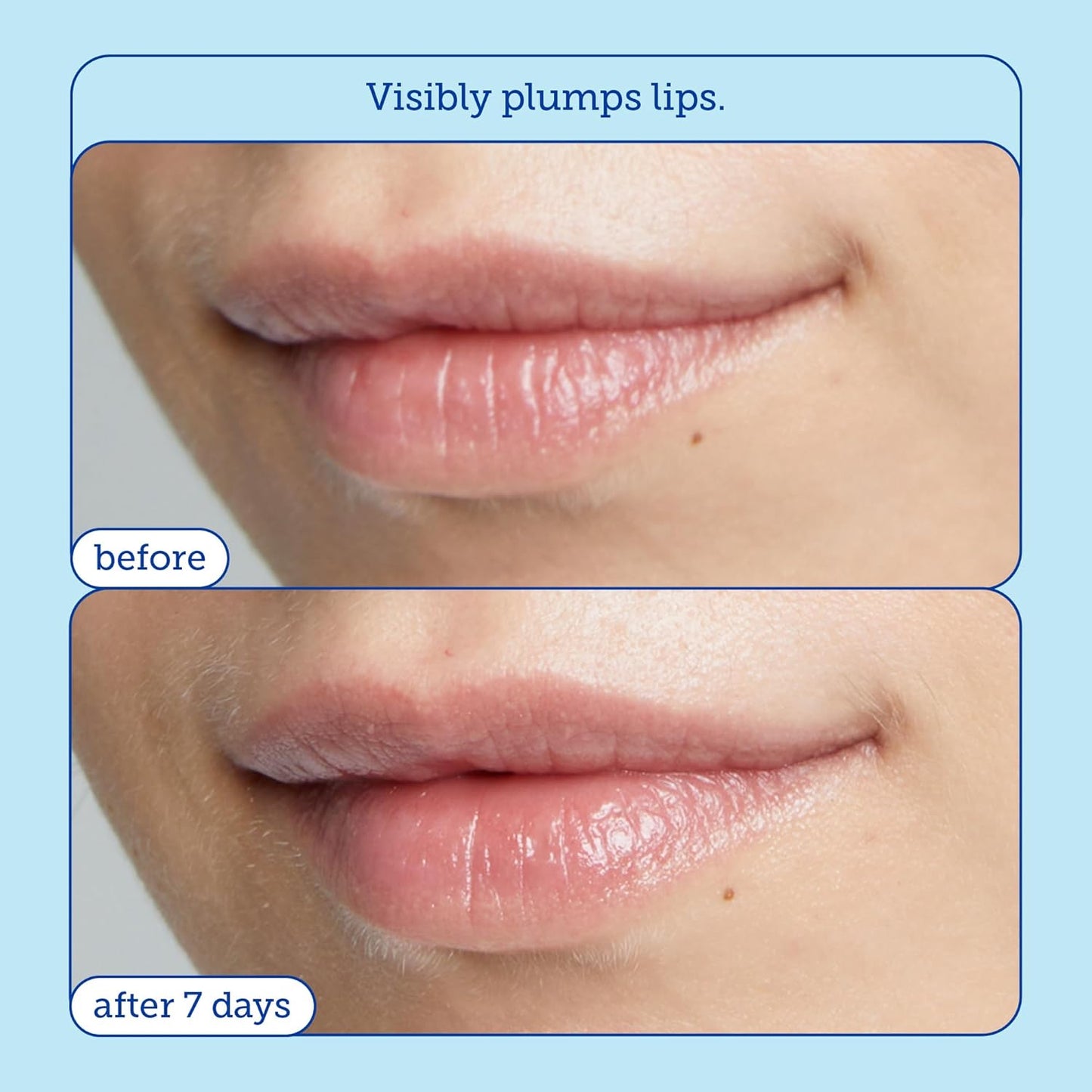 Skinfix Barrier+ Triple Lipid Lip Treatment: Nourish Dry, Chapped Lips With Our Volumizing Complex to Visibly Plump & Fill Fine Lines, 0.27 Oz